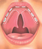 Cleft Palate Plastic Surgery on Getting Plastic Surgerycost Effective Surgery Information You Know