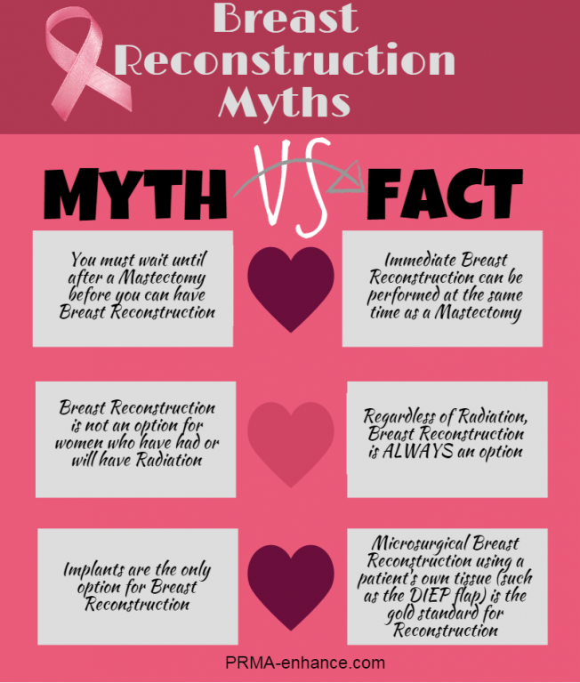 Breast reconstruction myths debunked