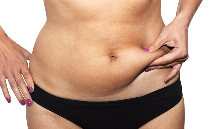 Muscle Tightening in Tummy Tuck Surgery - Explore Plastic Surgery