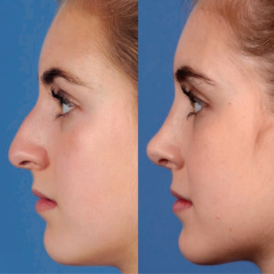 What's the difference between reconstructive and cosmetic procedures?