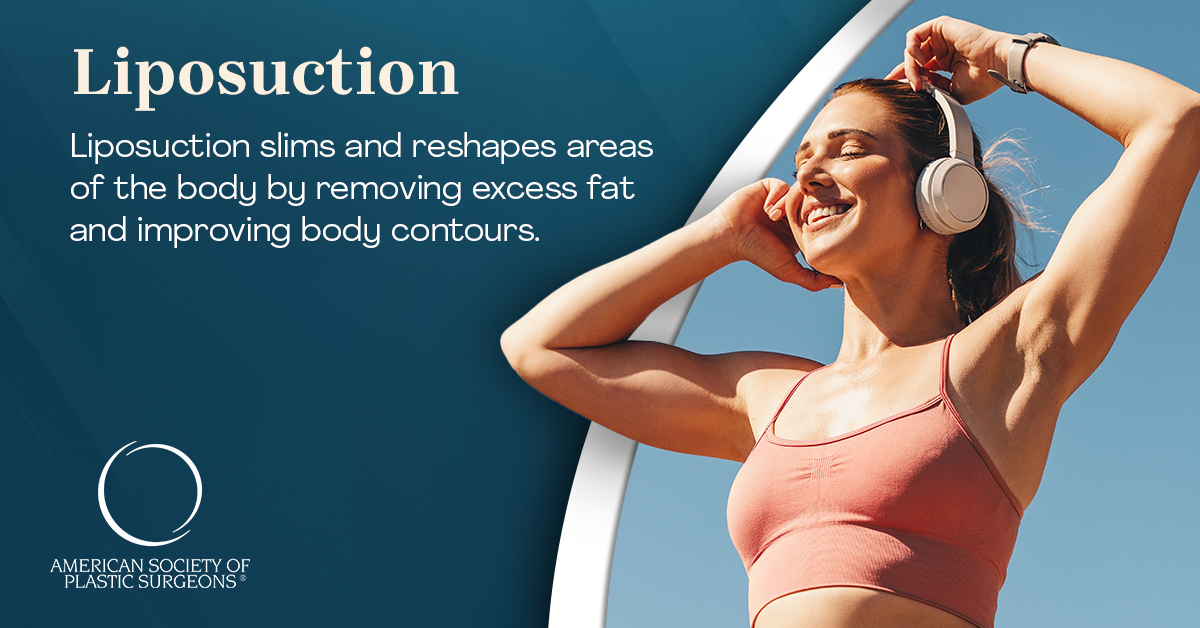 Liposuction Surgery- Get Rid Of Excess Fat & Shape Your Body