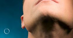 Changing your profile: Is a chin implant right for you?