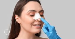 A closer look at corrective rhinoplasty techniques