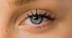 Focus on the eyes: The ins and outs of canthopexy and canthoplasty