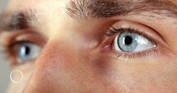 The growing popularity of blepharoplasty for male patients