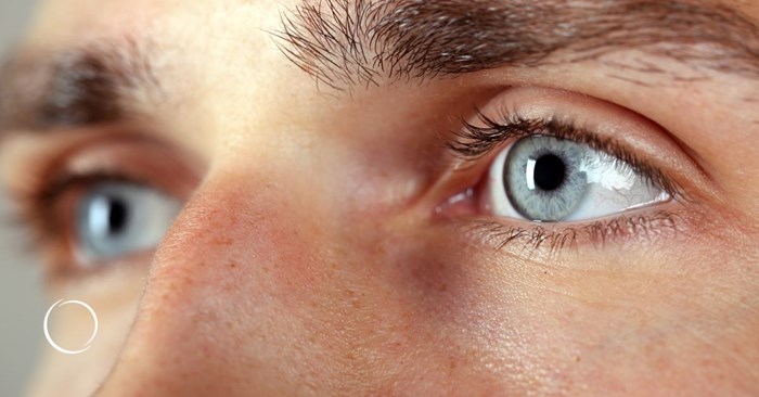 the growing popularity of blepharoplasty for male patients