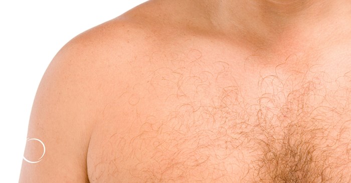 how plastic surgeons help men with gynecomastia