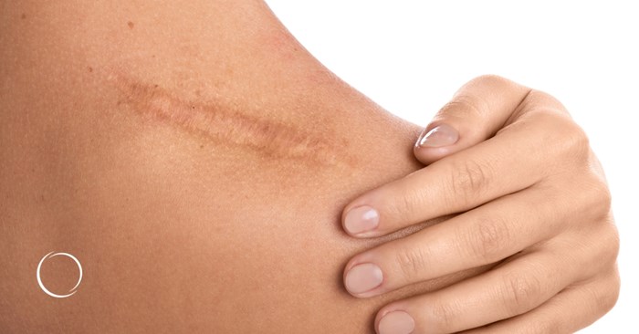 surgical and nonsurgical scar revision treatments