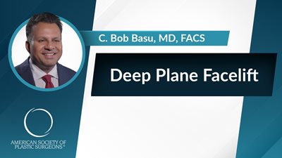 Deep Plane Facelift