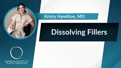 Dissolving Fillers