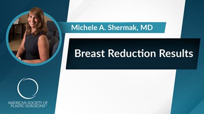 Breast Reduction Results